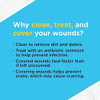 Band-Aid Gauze Pads Small - 10 ct Thumbnail Image