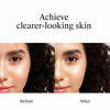 Neutrogena Rapid Clear Stubborn Acne Spot Gel - 1 oz Thumbnail Image