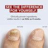 Kerasal Nail Fungal Nail Renewal Treatment - 0.33 oz Thumbnail Image