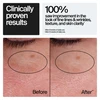Neutrogena Rapid Wrinkle Repair Regenerating Cream - 1.7 oz Thumbnail Image