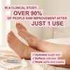 Kerasal One Step Exfoliating Moisturizer Foot Therapy - 1 oz Thumbnail Image