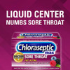Chloraseptic Max Sore Throat Lozenges Wild Berries - 15 ct Thumbnail Image