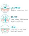 CeraVe Acne Foaming Cream Cleanser  - 5 oz Thumbnail Image