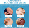 AneCream5  Topical Pain Relief with Lidocaine, 5% - 30 Grams Thumbnail Image