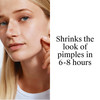 Neutrogena Stubborn Acne Ultra-Thin Blemish Patches - 24 ct Thumbnail Image