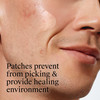 Neutrogena Stubborn Acne Ultra-Thin Blemish Patches - 24 ct Thumbnail Image
