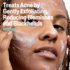 Cetaphil Gentle Clear 2% Salicylic Acid Pore Clearing Acne Cleanser - 8 oz Thumbnail Image