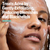 Cetaphil Gentle Clear 2% Salicylic Acid Pore Clearing Acne Cleanser - 8 oz Thumbnail Image