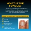 Fungi-Nail Antifungal Spray - 1 oz Thumbnail Image