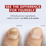 Kerasal Nail Fungal Nail Renewal Treatment - 0.33 oz