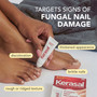 Kerasal Nail Fungal Nail Renewal Treatment - 0.33 oz