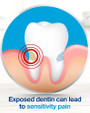 Sensodyne Maximum Strength with Fluoride Toothpaste Extra Whitening - 4 oz