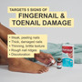 Kerasal Multi-Purpose Nail Repair Solution - 0.43 oz