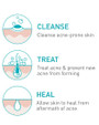 CeraVe Acne Foaming Cream Cleanser  - 5 oz