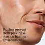 Neutrogena Stubborn Acne Ultra-Thin Blemish Patches - 24 ct