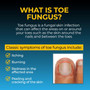 Fungi-Nail Antifungal Spray - 1 oz