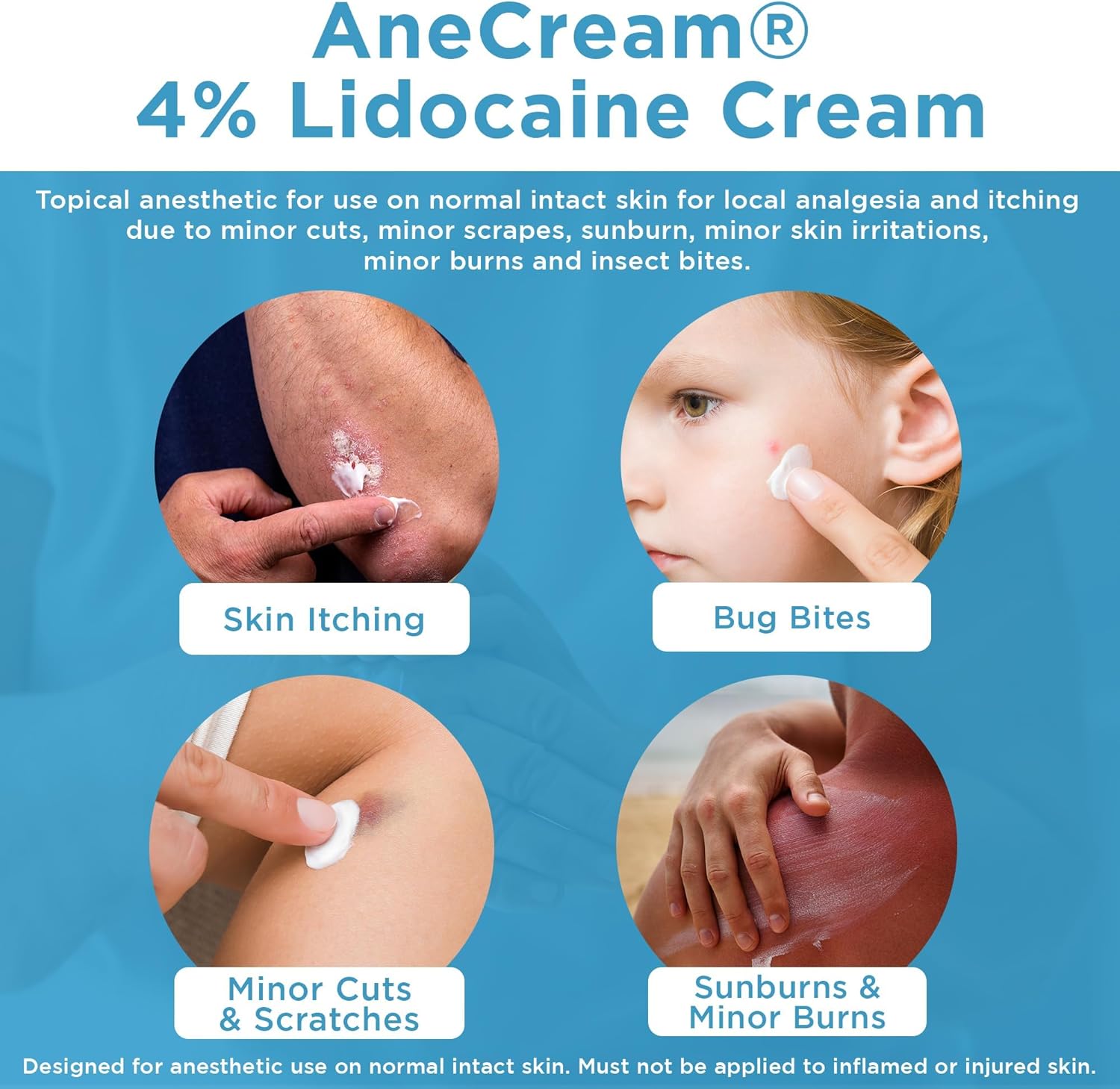 Focus Health – Ane Cream 4%, 15 Grams | Thrifty White Health