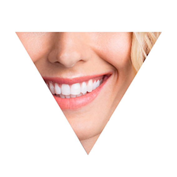 triangle_1
