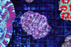 Purple Hypno Asian Acan Colony WYSIWYG - SAQ Coral Farm