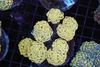 Gold Hammer Colony WYSIWYG - SAQ Coral Farm Gold Hammer Colony WYSIWYG - SAQ Coral Farm