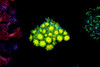 Freya Goniopora WYSIWYG - SAQ Coral Farm Freya Goniopora WYSIWYG - SAQ Coral Farm