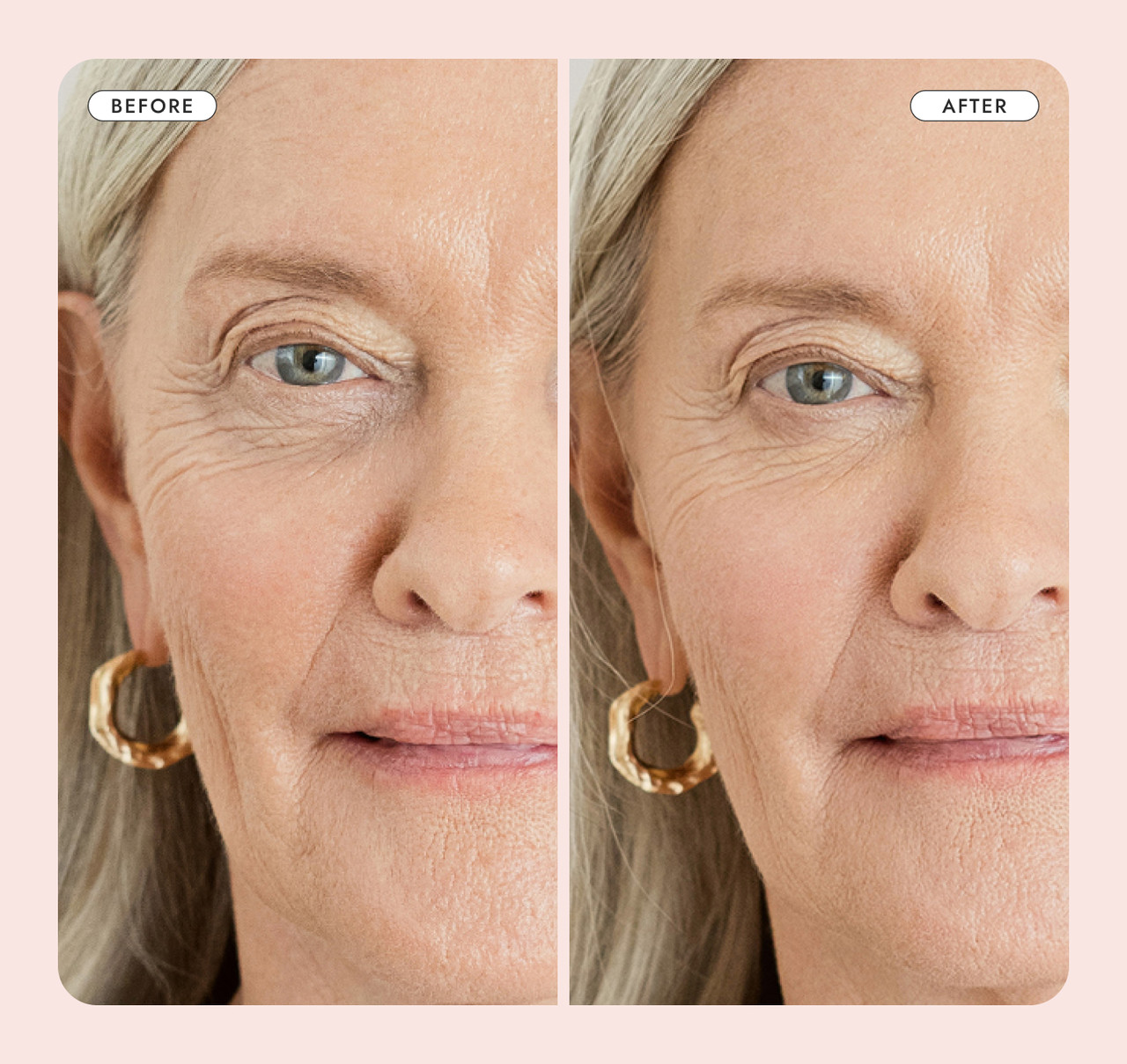 Revitalizes the look of dull and tired skin