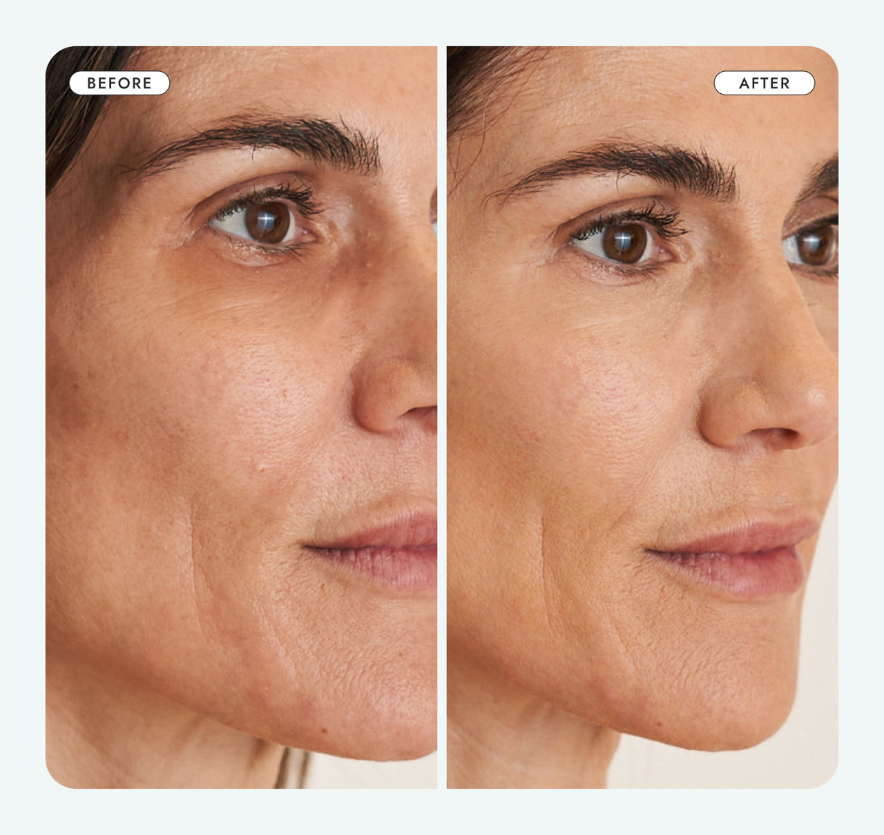 Before and After Youth Lift Face Cream-thumbnail