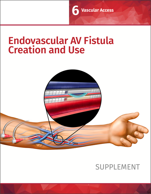 Endovascular AV Fistula Creation and Use Supplement (Free PDF)