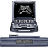 Battery for SonoSite MicroMaxx MTurbo Titan P07168 P07168-02 P07168-20 P07168-21