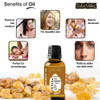 Frankincense oil, vaj Frankincense,olibanium,rreshire,temijan,shendeti,natyral,organik,vaj kurativ