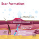 Biodermis Epi-Derm Natural Gel Sheeting - Mastopexy