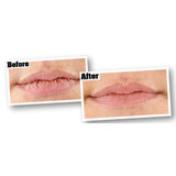 O'Keeffe's K07101-02  Cooling Lip Repair - Stick Image 1 O'Keeffe's K07101-02  Cooling Lip Repair - Stick Image 1