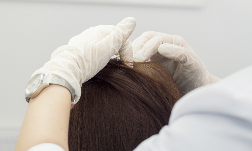 IMAGEN ANÁLISIS CAPILAR