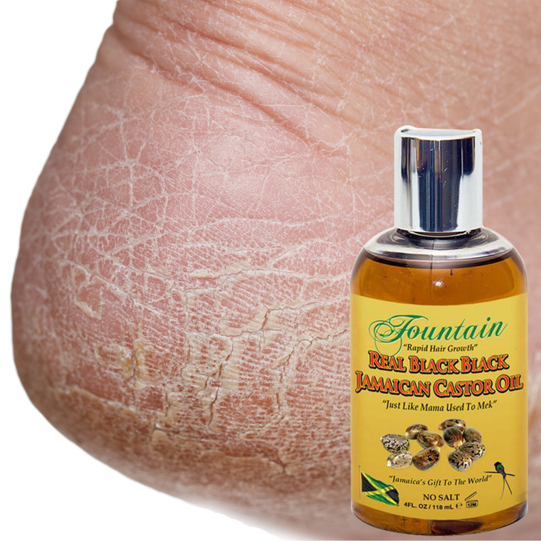 Fountain Real Black Black can be used as a moisturizer to repair dry or cracked skin including calloused hands, feet, elbows and knees and soften corns 