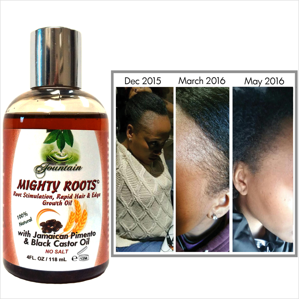 fountain-mighty-roots-with-jamaican-pimento-and-black-castor-oil-4oz-real-people-real-results.jpg