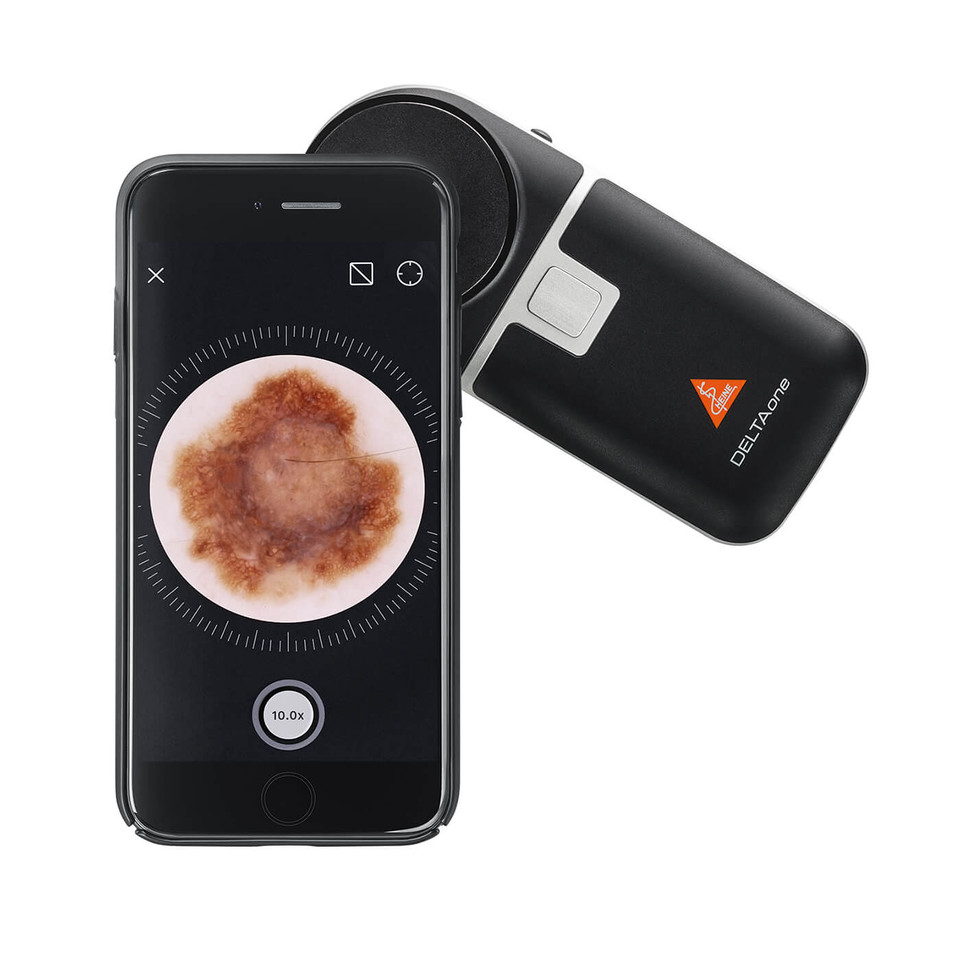 The Heine Delta ONE can link with smartphones for digital documentation