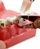 Orthodontic Braces Bracket Removing Pliers Artman Instruments