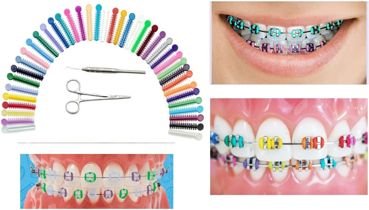 Artman Braces Color Bands Multicolored Dental Orthodontic Ligature Ties 1040 PCS