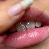 Colocacion Joyeria Dental  Crystales A Domicilio O Gabinete 1 Colocacion Joyeria Dental  Crystales A Domicilio O Gabinete 1