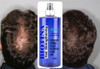 Loción De Biotina Capilar Profesional 500ml 4 Loción De Biotina Capilar Profesional 500ml 4