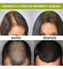 Loción Y Shampoo Anticaida Crecimiento Cabello Debil Quvek 3