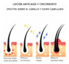 Loción Y Shampoo Anticaida Crecimiento Cabello Debil Quvek 7