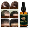 Aceite De Ricino Puro Y Orgánico/cuidado Del Pelo Y La Piel 3
