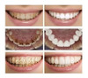 Blanqueador Dental Dientes Blancos 1
