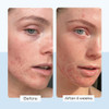 Creme Hidratante First Aid Beauty Ultra Repair 240ml 3 Creme Hidratante First Aid Beauty Ultra Repair 240ml 3
