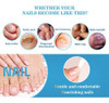 Nail Care Regen Sd Nail Care Regen Caneta Bio-frágil 10 Unid 7
