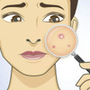 Kit Salicilico Anti Acne Y Manchas P/ Espalda Gluteos Idraet 1 Kit Salicilico Anti Acne Y Manchas P/ Espalda Gluteos Idraet 1