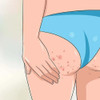 Kit Salicilico Anti Acne Y Manchas P/ Espalda Gluteos Idraet 2 Kit Salicilico Anti Acne Y Manchas P/ Espalda Gluteos Idraet 2