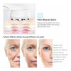 Dispositivo Portátil De Radiofrequência Mancha Acne Facial 6