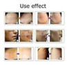 Dermapen Caneta Ultima M7 C/ Fio+2 Cartuchos Oferta Limitada 7 Dermapen Caneta Ultima M7 C/ Fio+2 Cartuchos Oferta Limitada 7